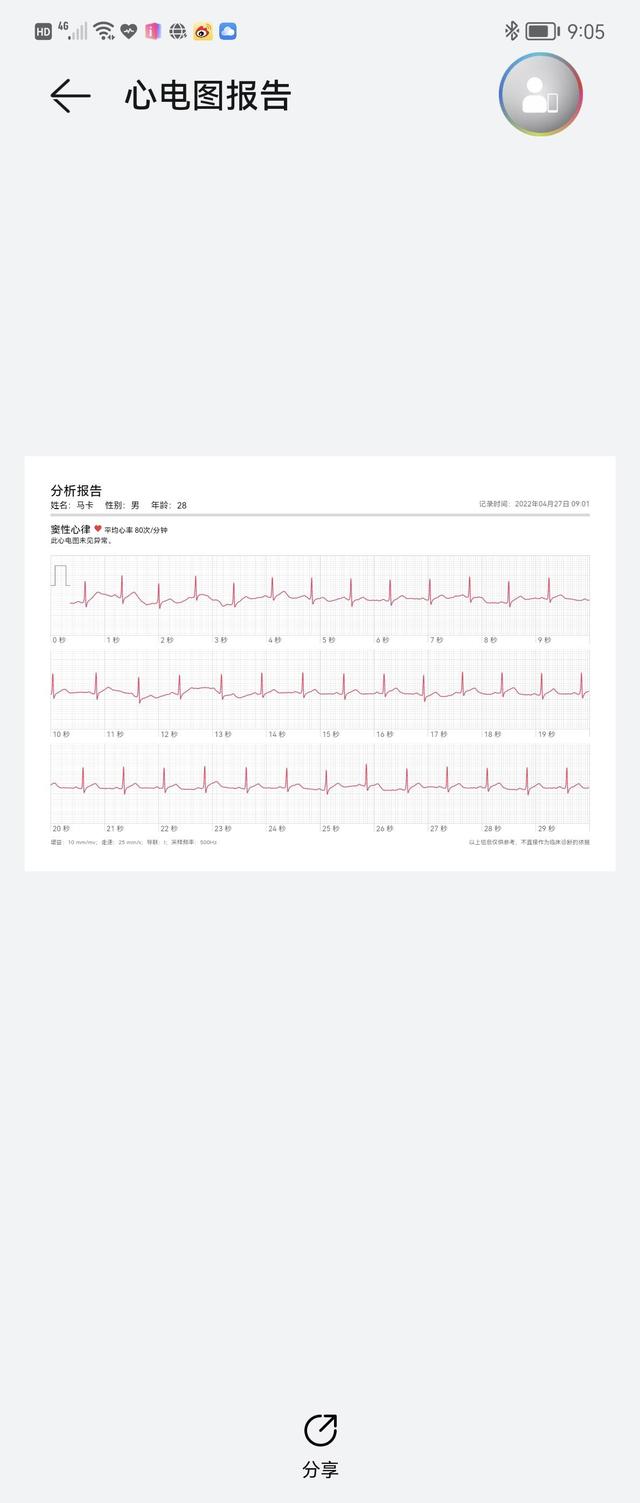 华为手表gt3pro功能介绍，华为watch gt3pro值得买吗？