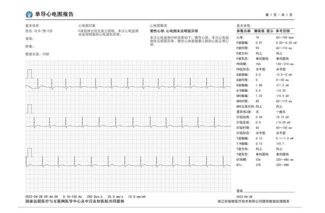 华为手表gt3pro功能介绍，华为watch gt3pro值得买吗？